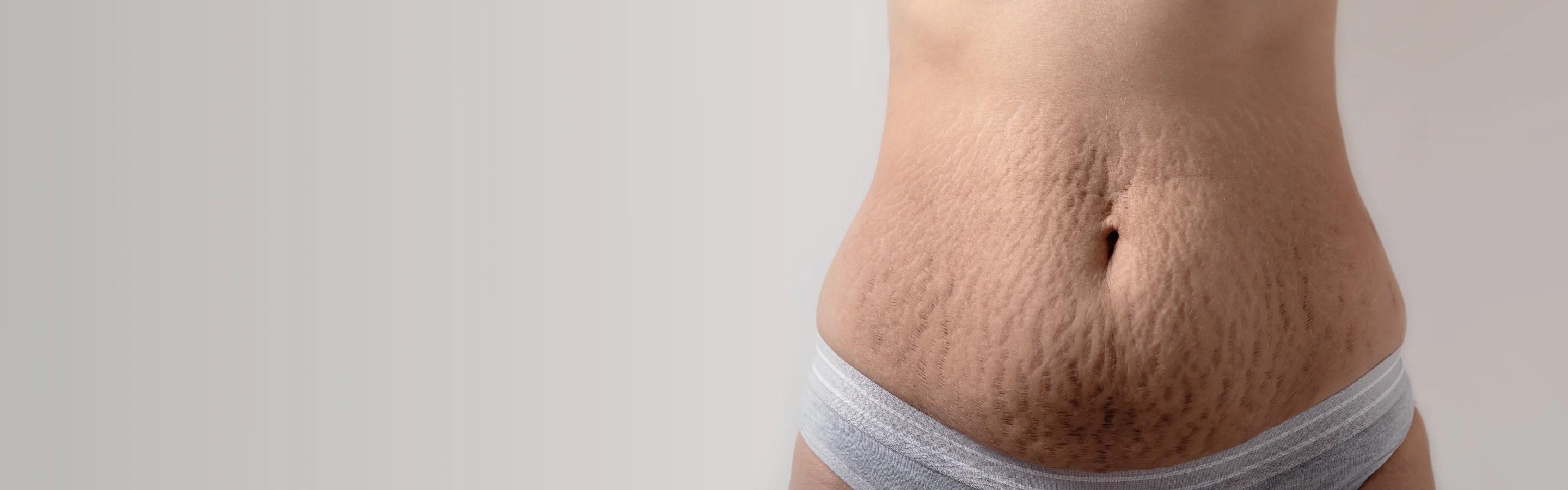Skin Sercret