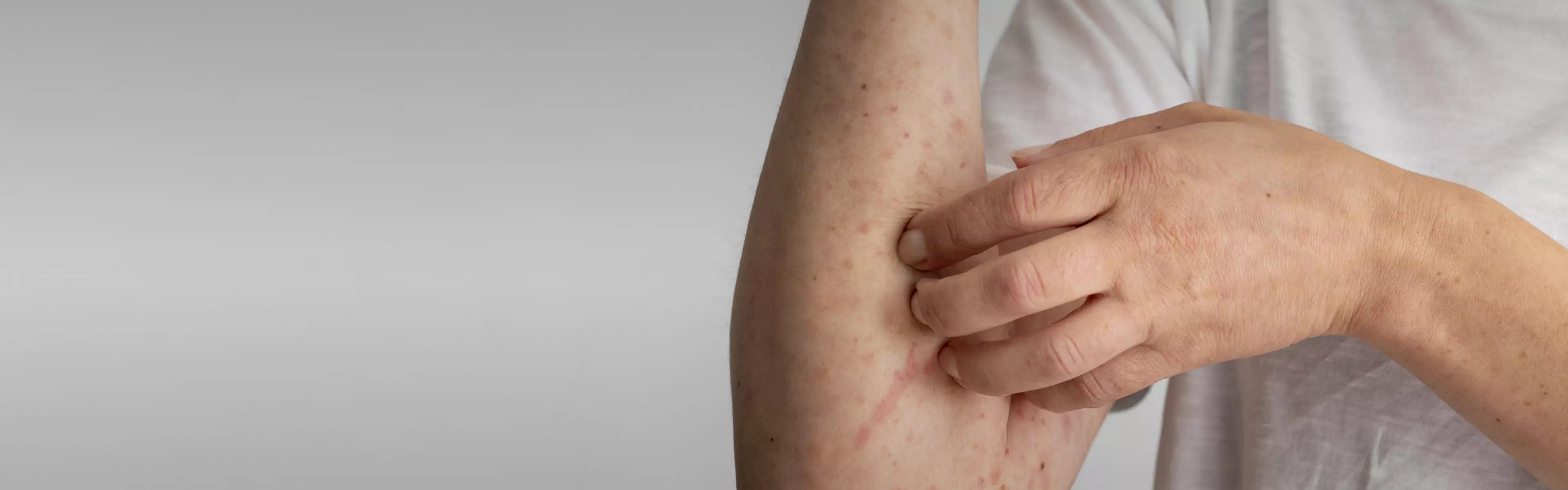 Skin Sercret