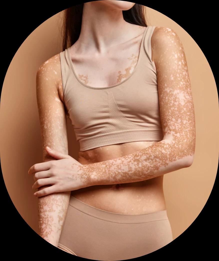 Skin Sercret