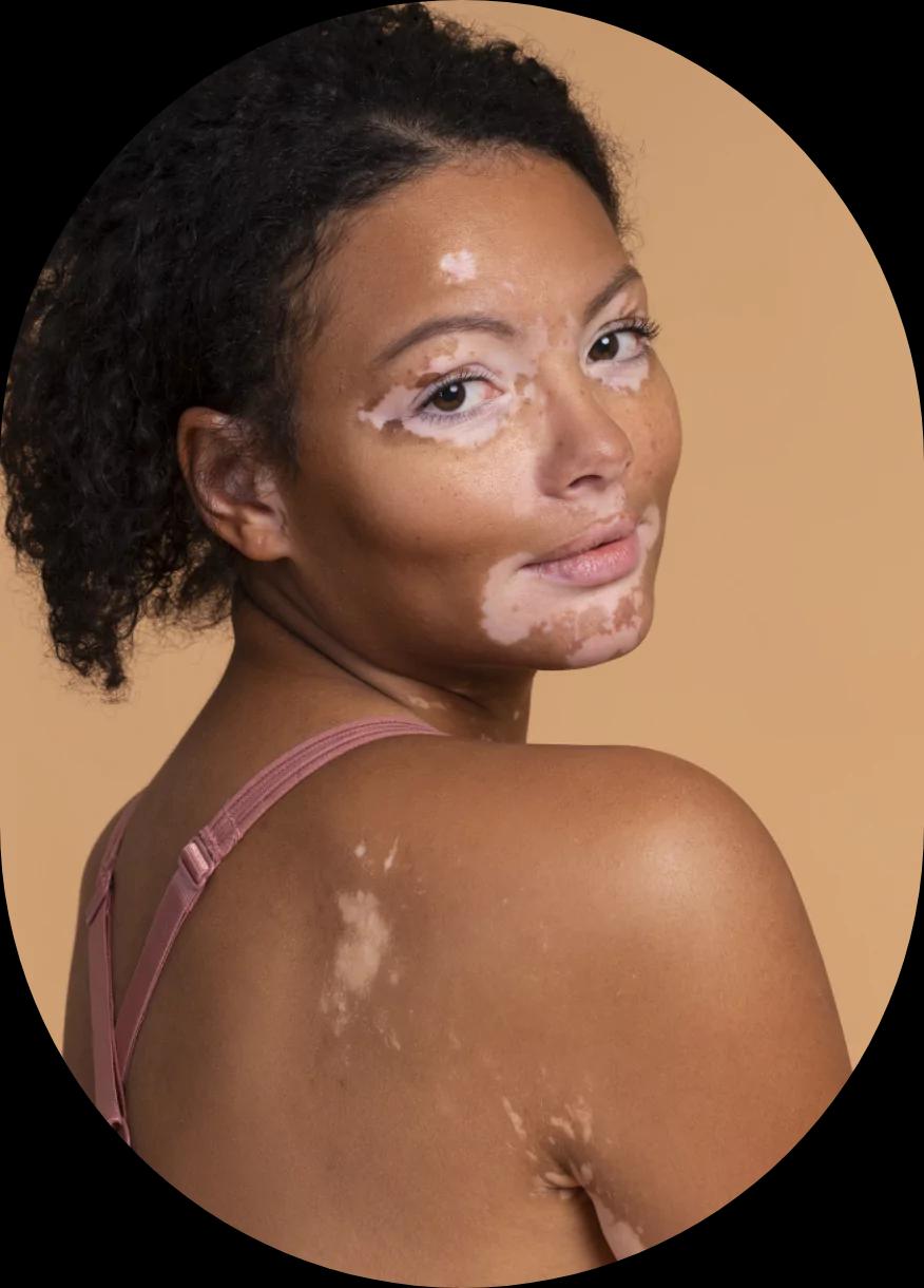 Skin Sercret